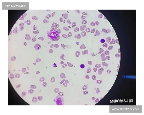 何为再生障碍性贫血